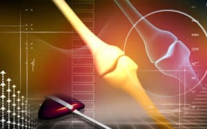 Костно здраве – как да го постигнем?